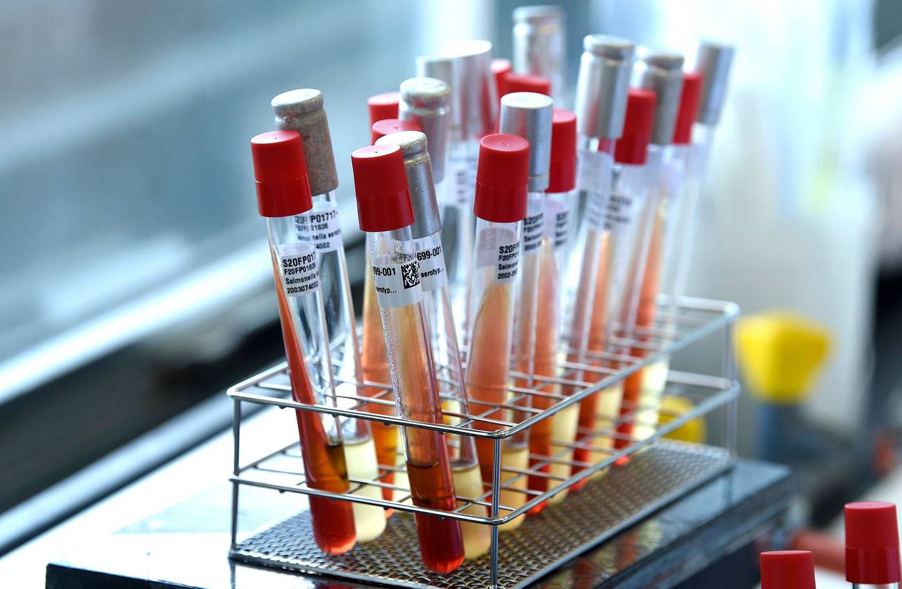 De wetenschappelijke onderzoeksinstelling Sciensano in Ukkel voert testen uit naar het coronavirus. De ziekte covid-19 wordt veroorzaakt door het virus SARS-CoV-2