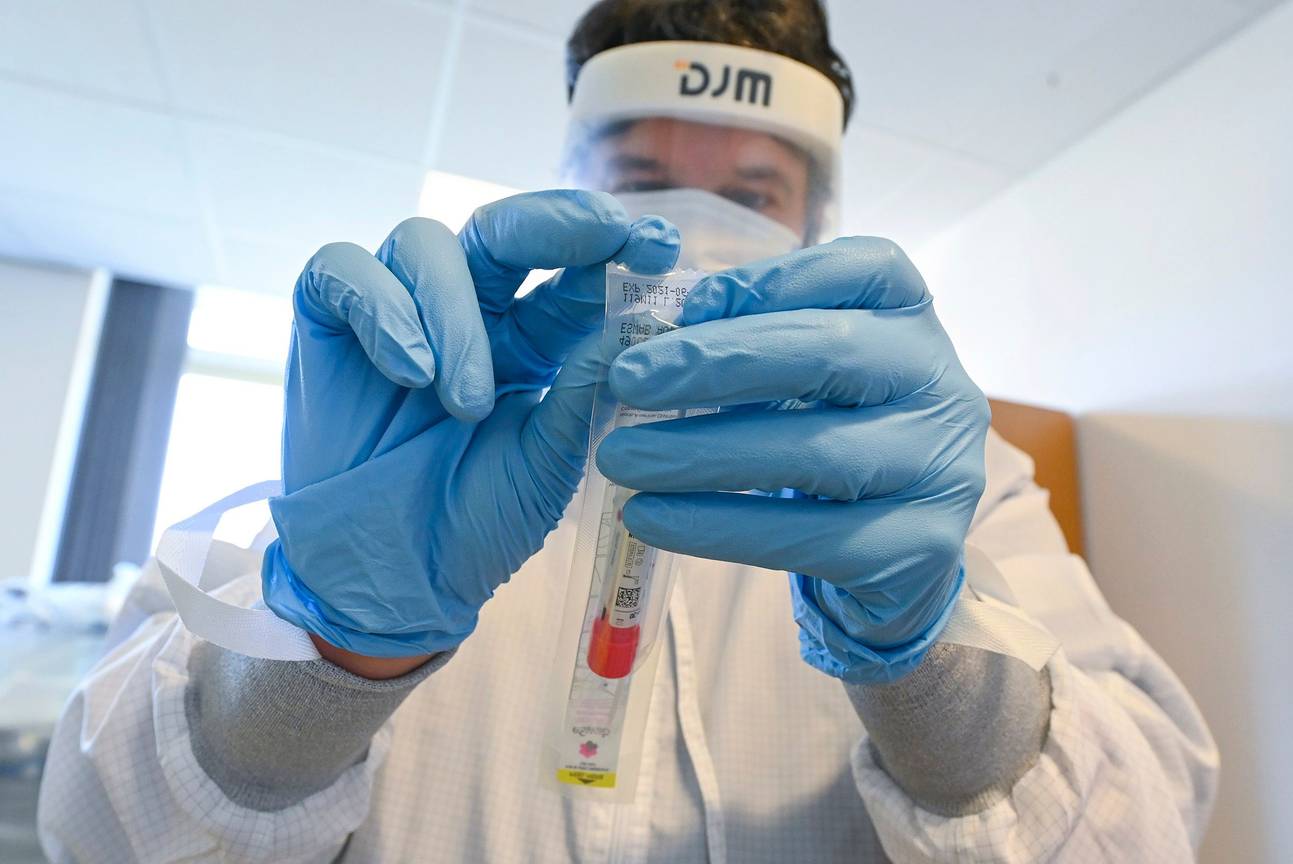 Ziekenhuizen gebruiken een testkit om het coronavirus, dat de ziekte covid-19 veroorzaakt, te detecteren