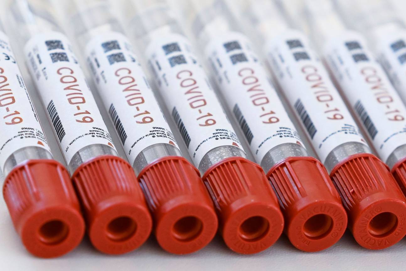 PCR-test naar covid-19, de ziekte veroorzaakt door het coronavirus