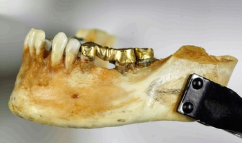 Mysterie verdwijning ijsdalvrouw Boorwegen gebit