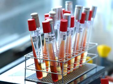 De wetenschappelijke onderzoeksinstelling Sciensano in Ukkel voert testen uit naar het coronavirus. De ziekte covid-19 wordt veroorzaakt door het virus SARS-CoV-2