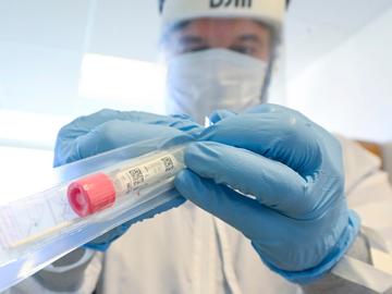 Ziekenhuizen gebruiken een testkit om het coronavirus, dat de ziekte covid-19 veroorzaakt, te detecteren
