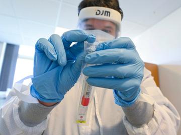 Ziekenhuizen gebruiken een testkit om het coronavirus, dat de ziekte covid-19 veroorzaakt, te detecteren