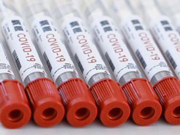 PCR-test naar covid-19, de ziekte veroorzaakt door het coronavirus