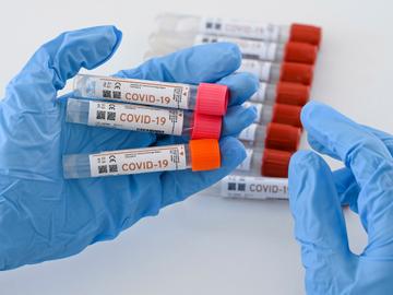 PCR-test naar covid-19, de ziekte veroorzaakt door het coronavirus