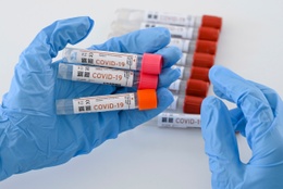PCR-test naar covid-19, de ziekte veroorzaakt door het coronavirus